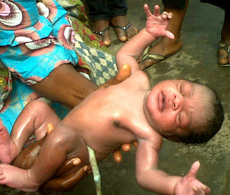 PHOTO: Who ABANDONED This Straight From The Womb Cuttie At A Dustbin. 1