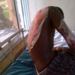 Wicked Woman Pours Hot Water On Her 18-Year-Old Step Son 2