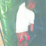 Woman burns 9 year old househelp Buttocks with electric iron 6