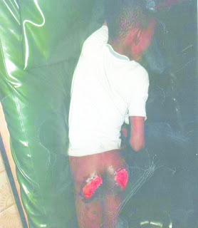 Woman burns 9 year old househelp Buttocks with electric iron 1