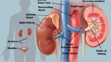 Police arraign 3 suspects for removing kidneys 13