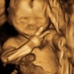 Ultrasound Scan Reveals Baby In The Womb, Displaying The V-Sign 24