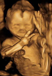 Ultrasound Scan Reveals Baby In The Womb, Displaying The V-Sign 2