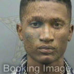 Woman bites off boyfriend’s finger during argument 1