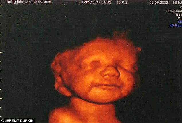 PHOTO: See the 3D scan of an unborn disabled baby’s smile 1