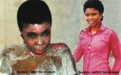 PHOTO: Man pours pot of boiling stew and lighted stove on girlfriend 2