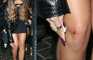 Rihanna Attacked With A Bottle In London 1