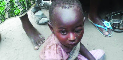 PHOTO: Boy Survives, After His Mother Buried Him For 2 Days 3
