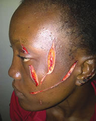 Choristers At War: Women Arraigned for Cutting Neighbour's Face With Blade 6
