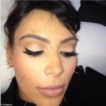 Kim Kardashian's Face Full Of Needles As She Undergoes Acupuncture Session 5