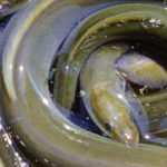 PHOTOS: Eel Removed From Man After Getting Stuck And Chewed Into His Colon 1