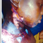 PHOTO: Man Pours Hot Water On 13-Yyear-Old Housemaid 10