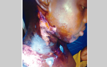 PHOTO: Man Pours Hot Water On 13-Yyear-Old Housemaid 1