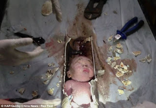 Photos And Video Of New Born Baby Rescued From A Toilet Pipe After Being Flushed Away By Parents In China 3