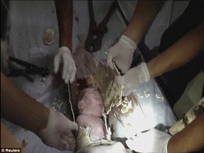 Newborn Baby Rescued ALIVE