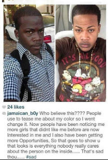 OMG! Boy Goes From Very Black To White And Defends His Bleaching 3