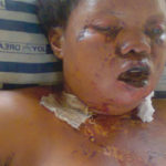 OMG Housewife Disfigures Husband's Mistress Face With Acid 1