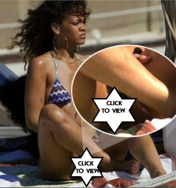 Picture Of Rihanna Carelessly Exposing Her Private Part 1