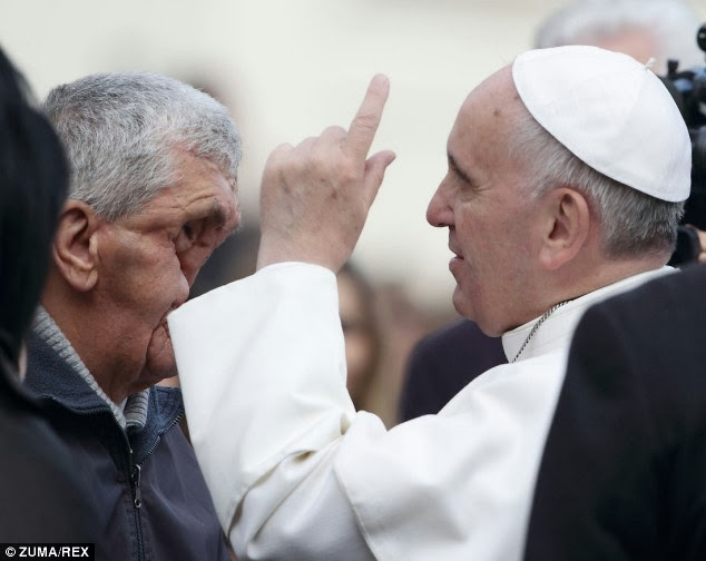Awwww Pope Francis Halts His Weekly Service Again To Hug Man With Dis-Figured Face 8