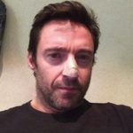 Wolverine actor, Hugh Jackman diagnosed with Cancer 4