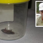 Wow This 2cm Cockroach Was Removed From A Man’s Ear 4