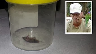 Wow This 2cm Cockroach Was Removed From A Man’s Ear 3