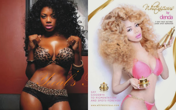 Dencia Talks To Ebony Magazine, Says ''Yes Whitenicious Will Bleach Your Skin'' 9