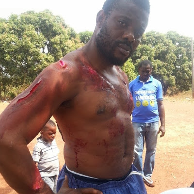 Check Out Emeka Enyiocha's Horrible Looking Wounds 4