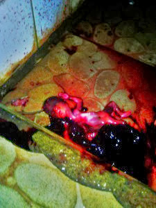 Another Dead Baby Found In University Of Calaber (UNICAL) Female Hostel 2