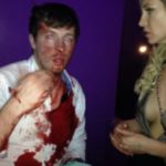 Thugs beat up Big Brother star Josie Gibson's brother because he is DEAF and couldn't give them directions 2