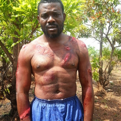 Check Out Emeka Enyiocha's Horrible Looking Wounds 5