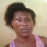 PHOTO: Man Blinds Housewife Over Sex 1