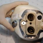 The first patient in the world to be given an artificial heart dies 75 days after transplant 1
