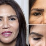 This Woman Runined her eyelashes by using fakes now she's had world's first double eyelash and eyebrow transplant using hair from the back of her head 9