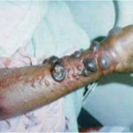 Read US State Department Press Release On How To Handle Ebola Virus 1