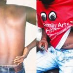 Nigerians Share Stories Of How They Were Tricked Into Selling Their Kidney's And Got Duped 18