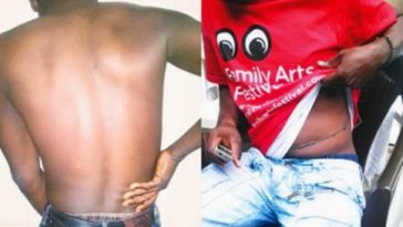 Nigerians Share Stories Of How They Were Tricked Into Selling Their Kidney's And Got Duped 5
