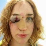 PHOTO: Woman Attacked At Notting Hill Carnival After Standing Up To A Man Who Grabbed Her Ass 10