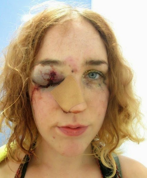 PHOTO: Woman Attacked At Notting Hill Carnival After Standing Up To A Man Who Grabbed Her Ass 1