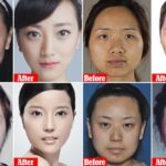 Chinese Women Doing Plastic surgery so drastic they can't get past airport security On Their way home 9