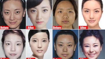 Chinese Women Doing Plastic surgery so drastic they can't get past airport security On Their way home 8