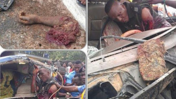 PHOTO: Policeman gets his hand chopped off while trying to stop a bus driver 7