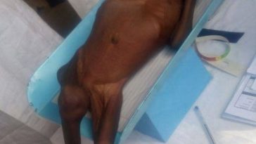 See Photos of a Starving and Malnourished 2-year-old Child From Gombe State 7