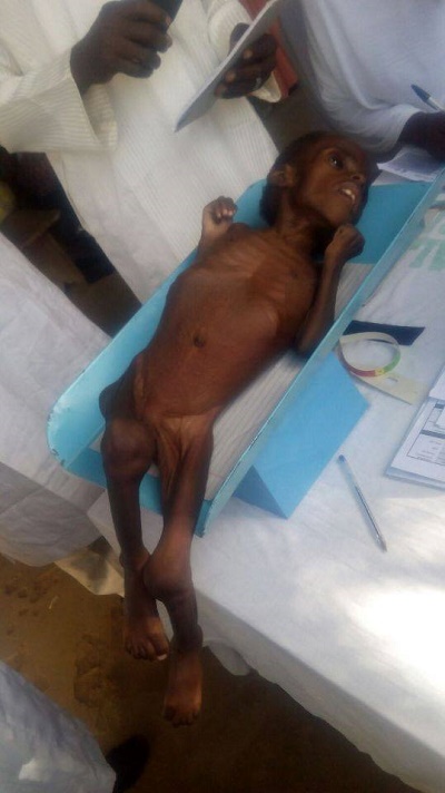 See Photos of a Starving and Malnourished 2-year-old Child From Gombe State 2