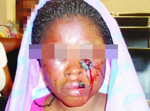 Husband Beats Up, Stabs Wife Close To Her Eyes Because She Didn't Open The Gate For Him 1