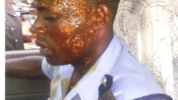 Man arrested for bathing police officer with ‘hot soup' [PHOTO] 3