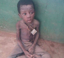 Boy Rescued In Chains Was Punished By His Father For Stealing Soup Cooked By His STEP MUM 6