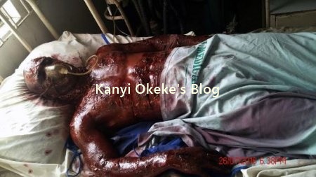 Nollywood Actor Ani Iyoho Badly Burnt in Fire Stunt Gone Wrong [PHOTOS + VIDEO] 2
