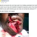 OMG! See What a Jealous Wife Did to Her Husband for Cheating on her [GRAPHIC PHOTO] 13