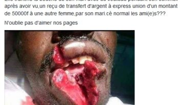 OMG! See What a Jealous Wife Did to Her Husband for Cheating on her [GRAPHIC PHOTO] 6